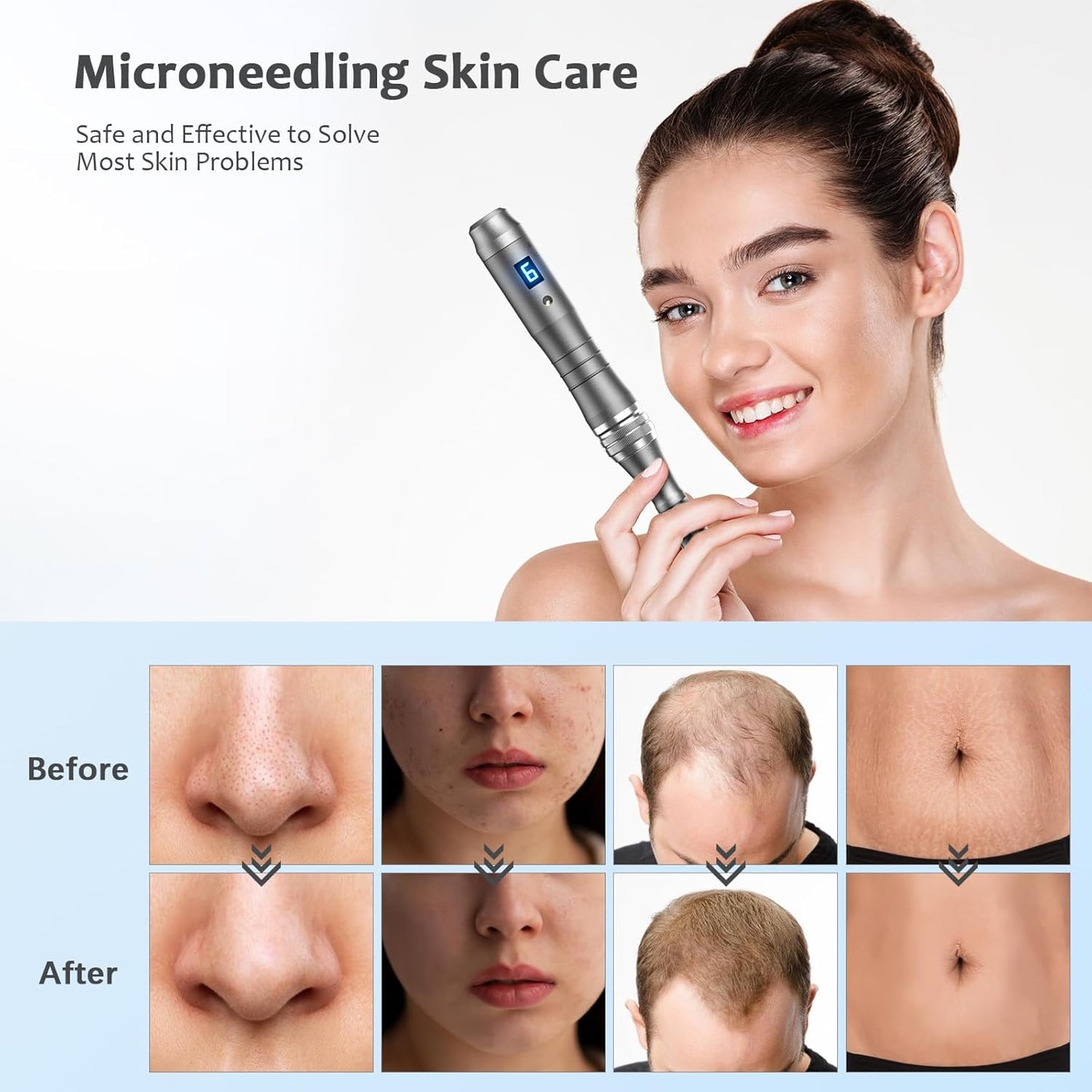 Dr. Pen M8 Microneedling Pen